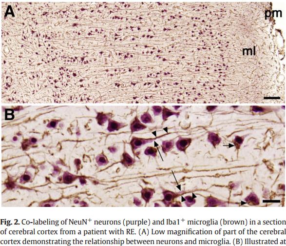 Microglia neuron