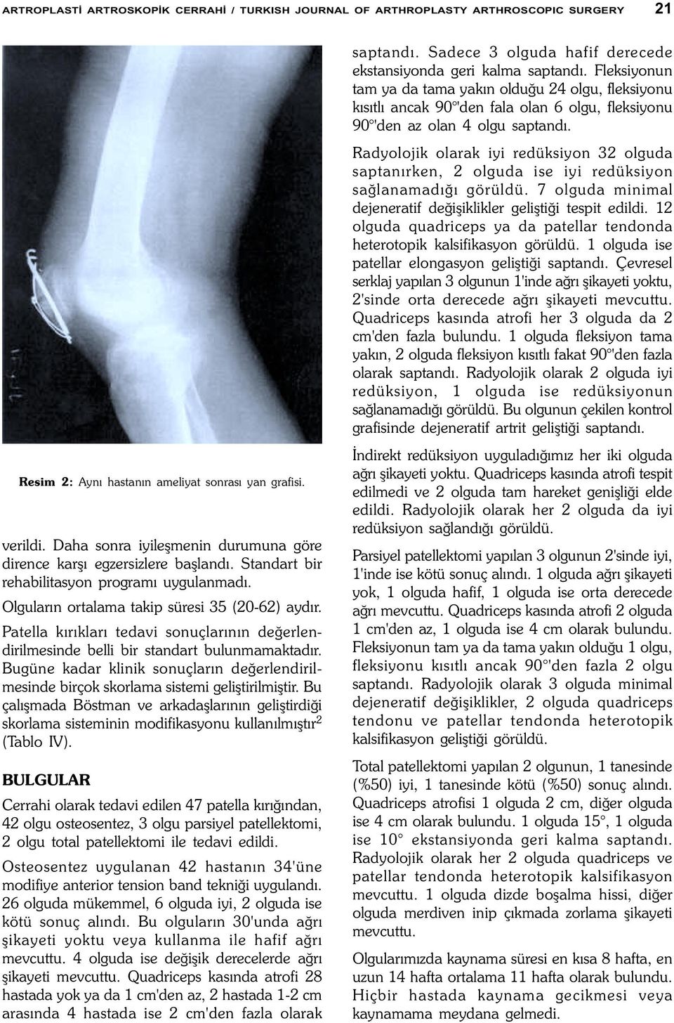 Patella kýrýklarý tedavi sonuçlarýnýn deðerlendirilmesinde belli bir standart bulunmamaktadýr. Bugüne kadar klinik sonuçlarýn deðerlendirilmesinde birçok skorlama sistemi geliþtirilmiþtir.