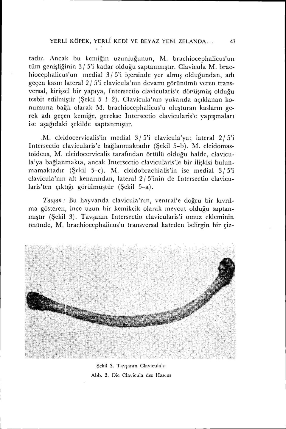 dörı.üşmüş olduğu tesbit edilmiştir (Şekil 5 1-2). Clavicula'nın yukarıda açıklanan konumuna bağlı olarak M.