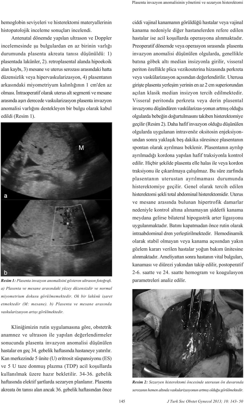 retroplasental alanda hipoekoik alan kayb, 3) mesane ve uterus serozas aras ndaki hatta düzensizlik veya hipervaskularizasyon, 4) plasentan n arkas ndaki miyometriyum kal nl n n 1 cm'den az olmas.