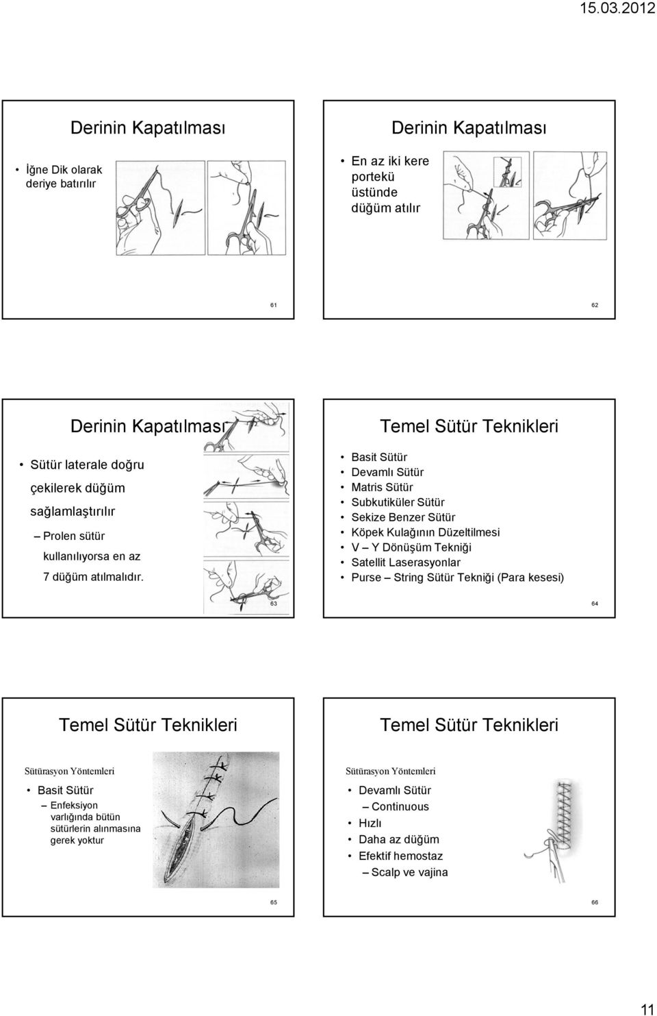 Temel Basit Sütür Devamlı Sütür Matris Sütür Subkutiküler Sütür Sekize Benzer Sütür Köpek Kulağının Düzeltilmesi V Y Dönüşüm Tekniği Satellit Laserasyonlar