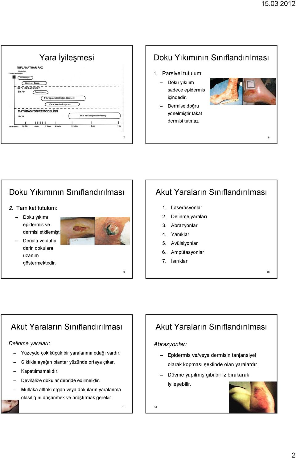 Avülsiyonlar 6. Ampütasyonlar 7. Isırıklar 10 Delinme yaraları: Yüzeyde çok küçük bir yaralanma odağı vardır. Sıklıkla ayağın ğ plantar yüzünde ortaya çıkar. Kapatılmamalıdır.