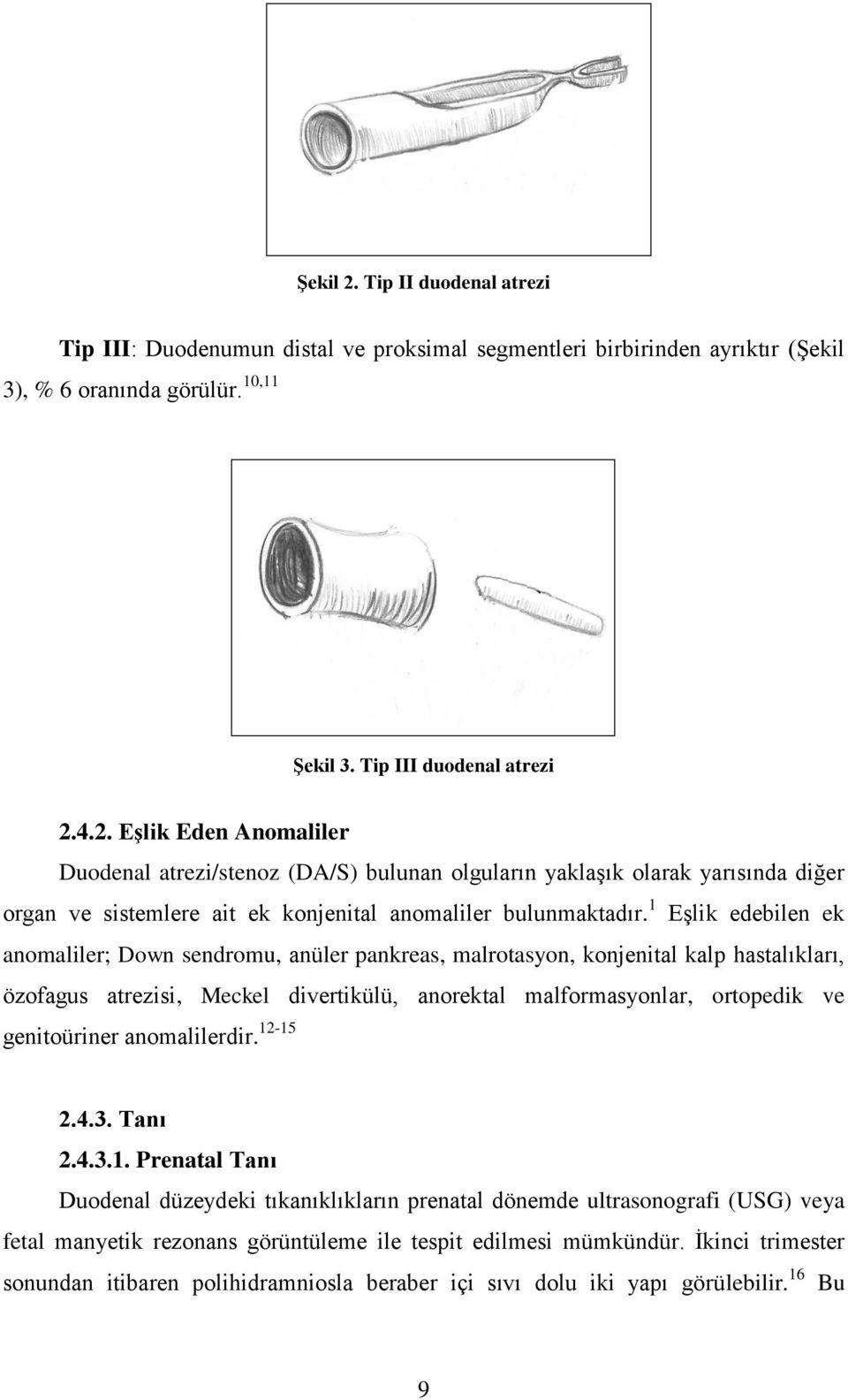 anomalilerdir. 12-15 2.4.3. Tanı 2.4.3.1. Prenatal Tanı Duodenal düzeydeki tıkanıklıkların prenatal dönemde ultrasonografi (USG) veya fetal manyetik rezonans görüntüleme ile tespit edilmesi mümkündür.