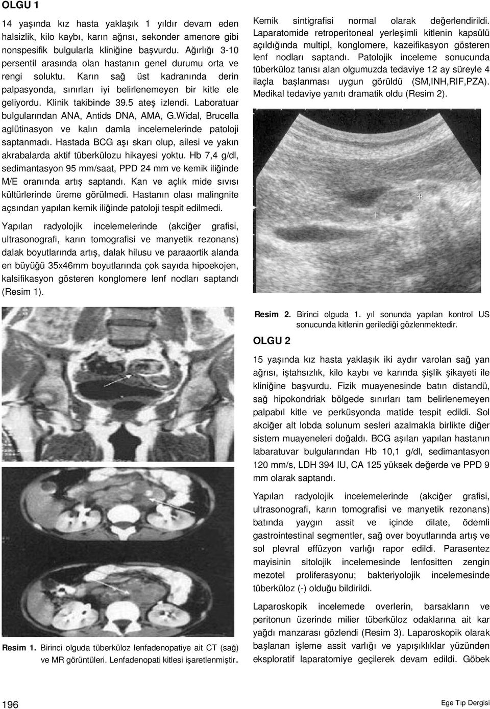 Klinik takibinde 39.5 ateş izlendi. Laboratuar bulgularından ANA, Antids DNA, AMA, G.Widal, Brucella aglütinasyon ve kalın damla incelemelerinde patoloji saptanmadı.