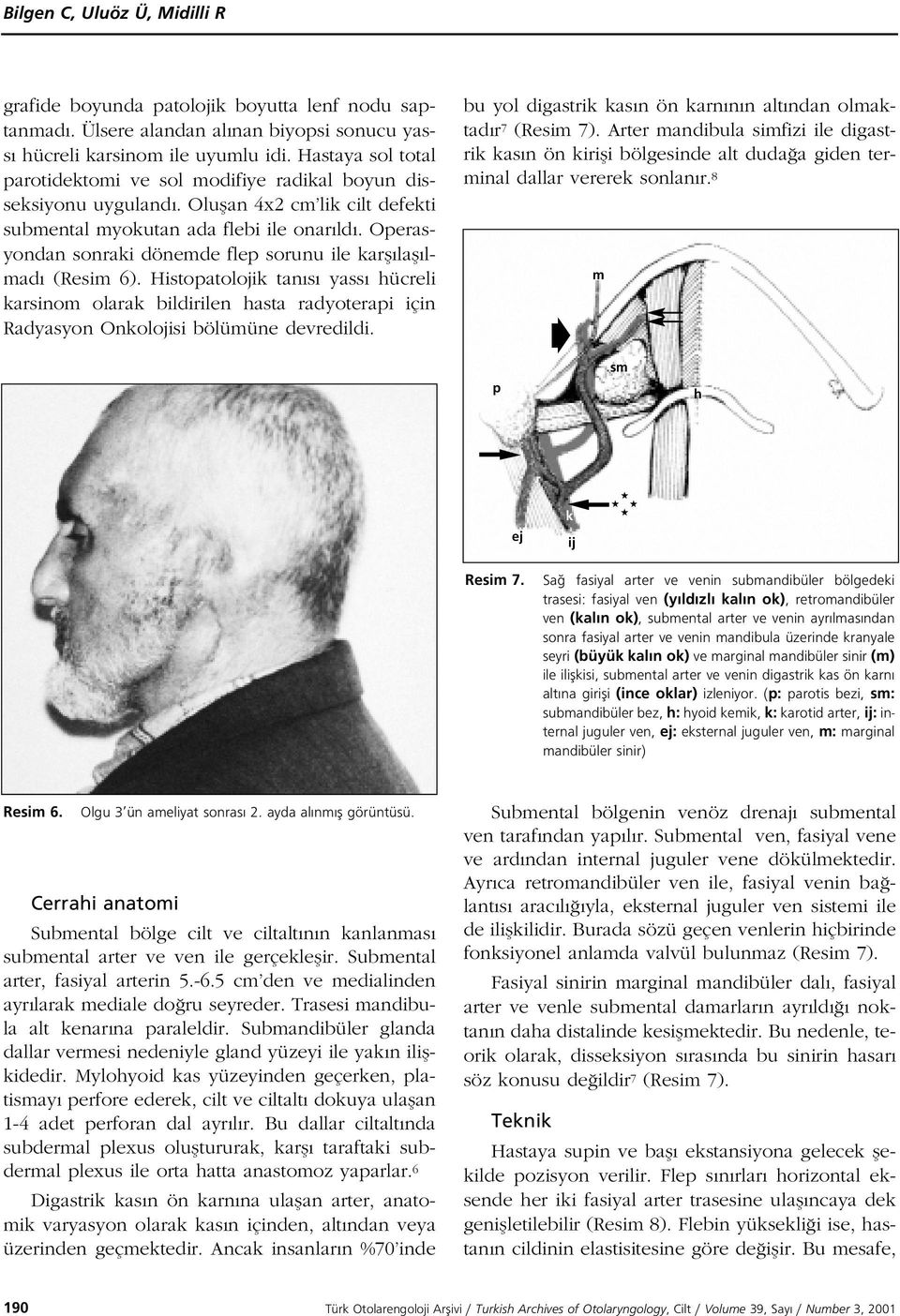 Operasyondan sonraki dönemde flep sorunu ile karfl lafl lmad (Resim 6). Histopatolojik tan s yass hücreli karsinom olarak bildirilen hasta radyoterapi için Radyasyon Onkolojisi bölümüne devredildi.