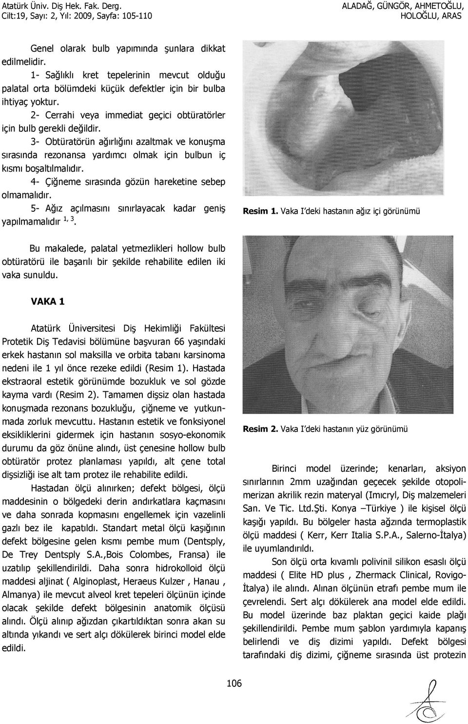 3- Obtüratörün ağırlığını azaltmak ve konuşma sırasında rezonansa yardımcı olmak için bulbun iç kısmı boşaltılmalıdır. 4- Çiğneme sırasında gözün hareketine sebep olmamalıdır.