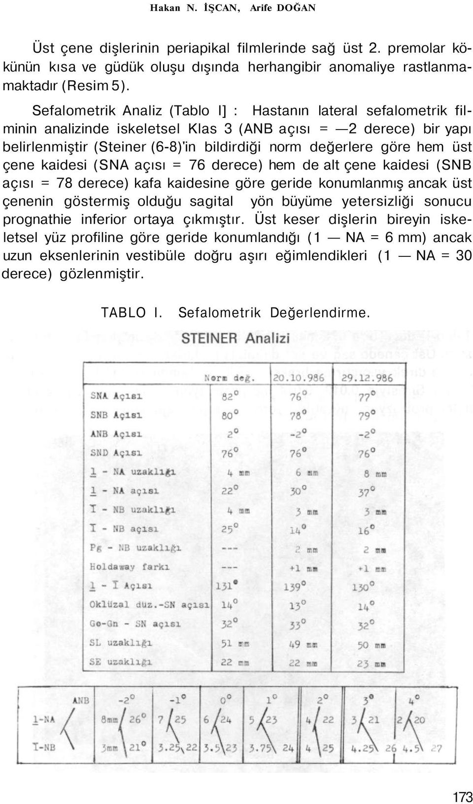 üst çene kaidesi (SNA açısı = 76 derece) hem de alt çene kaidesi (SNB açısı = 78 derece) kafa kaidesine göre geride konumlanmış ancak üst çenenin göstermiş olduğu sagital yön büyüme yetersizliği