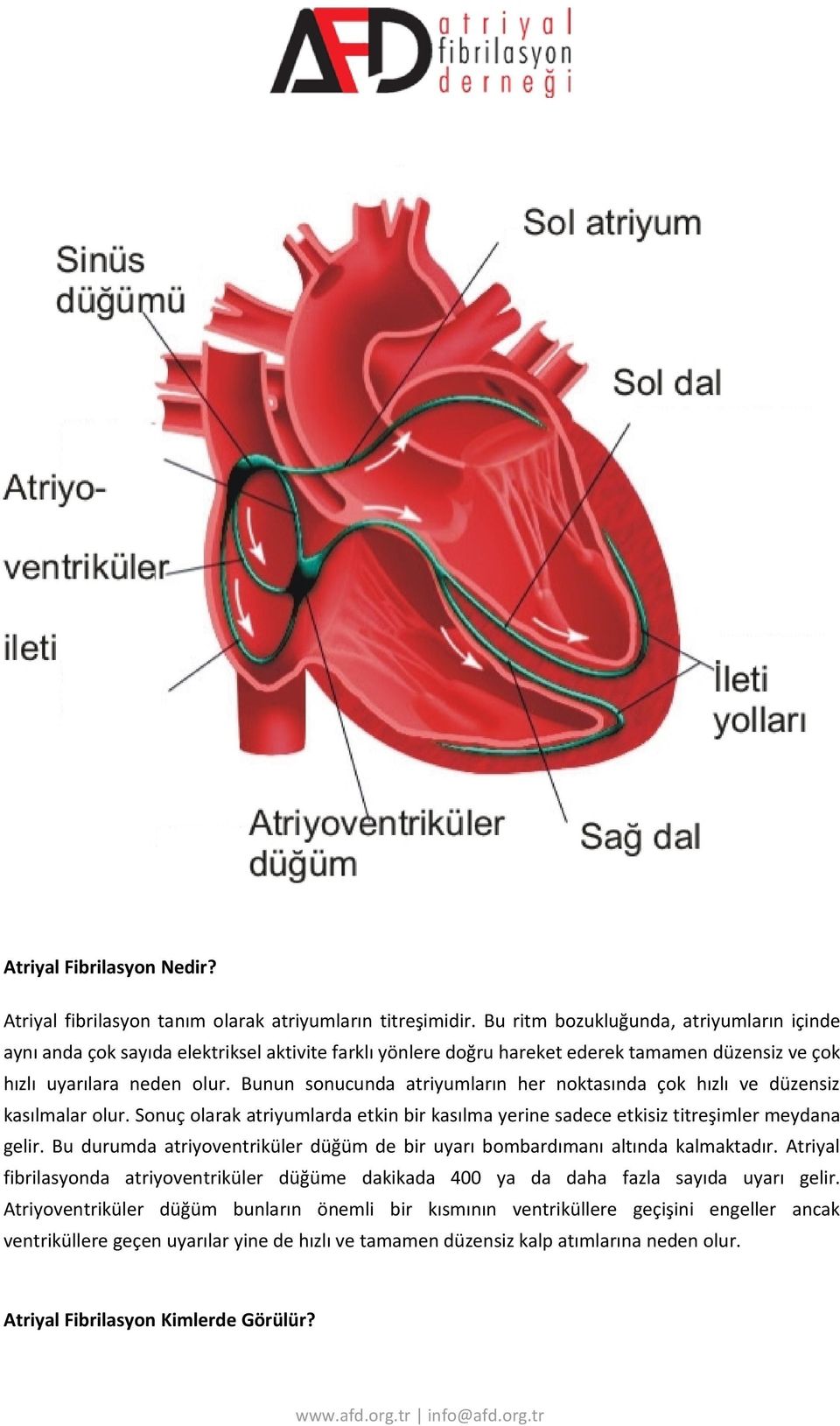 Bunun sonucunda atriyumların her noktasında çok hızlı ve düzensiz kasılmalar olur. Sonuç olarak atriyumlarda etkin bir kasılma yerine sadece etkisiz titreşimler meydana gelir.