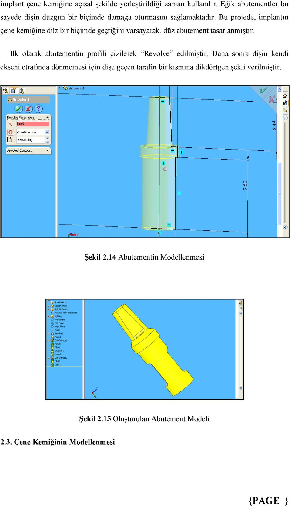 Bu projede, implantın çene kemiğine düz bir biçimde geçtiğini varsayarak, düz abutement tasarlanmıştır.