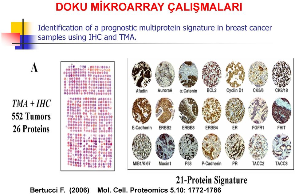 cancer samples using IHC and TMA. Bertucci F.