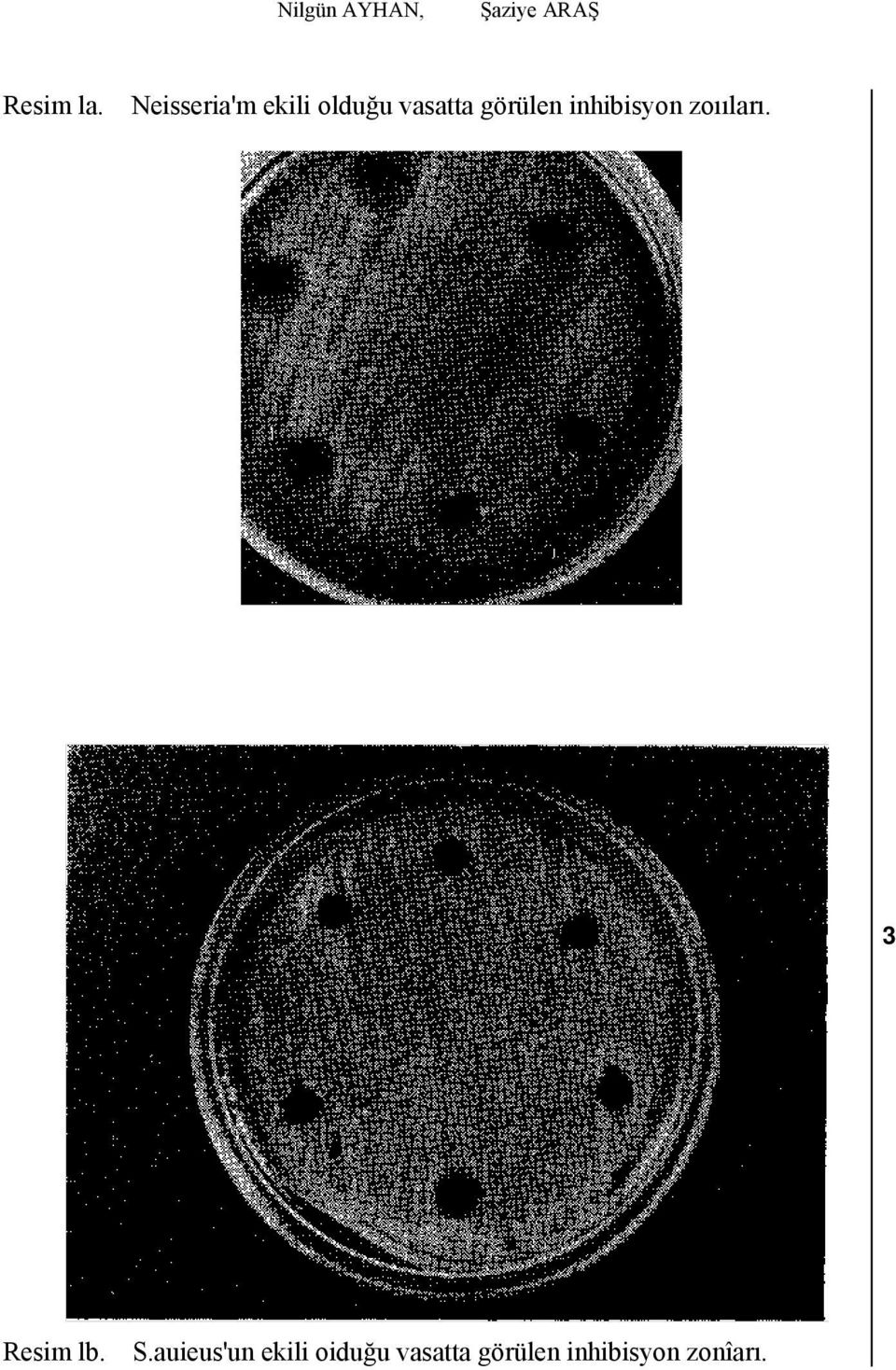inhibisyon zoııları. 3 Resim lb. S.