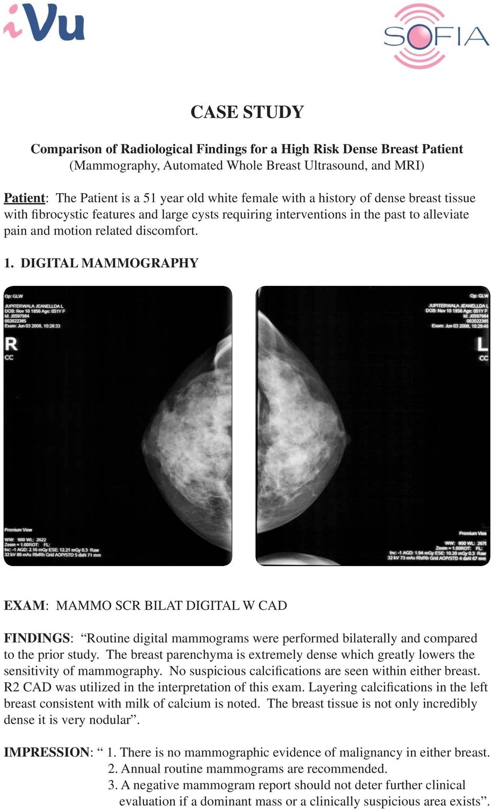 DIGITAL MAMMOGRAPHY EXAM: MAMMO SCR BILAT DIGITAL W CAD FINDINGS: Routine digital mammograms were performed bilaterally and compared to the prior study.