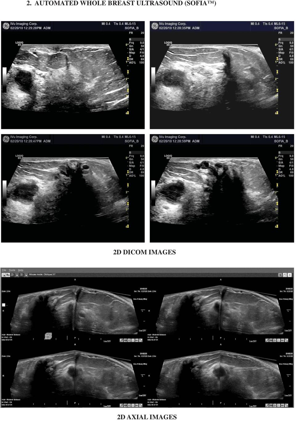 (SOFIA ) 2D DICOM