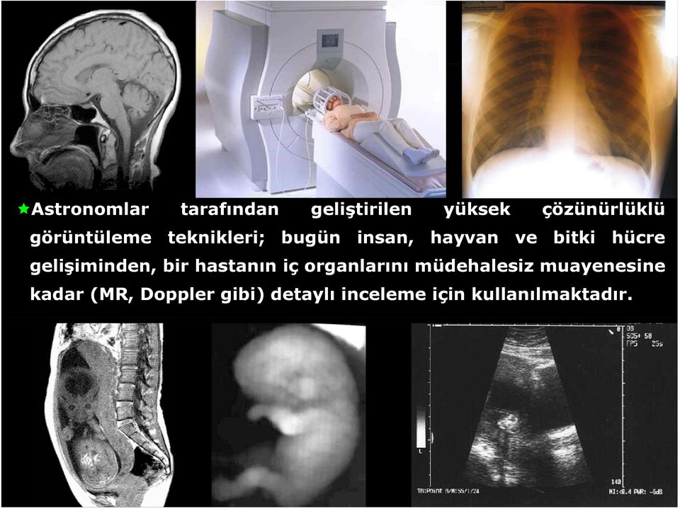 gelişiminden, bir hastanın içorganlarını müdehalesiz