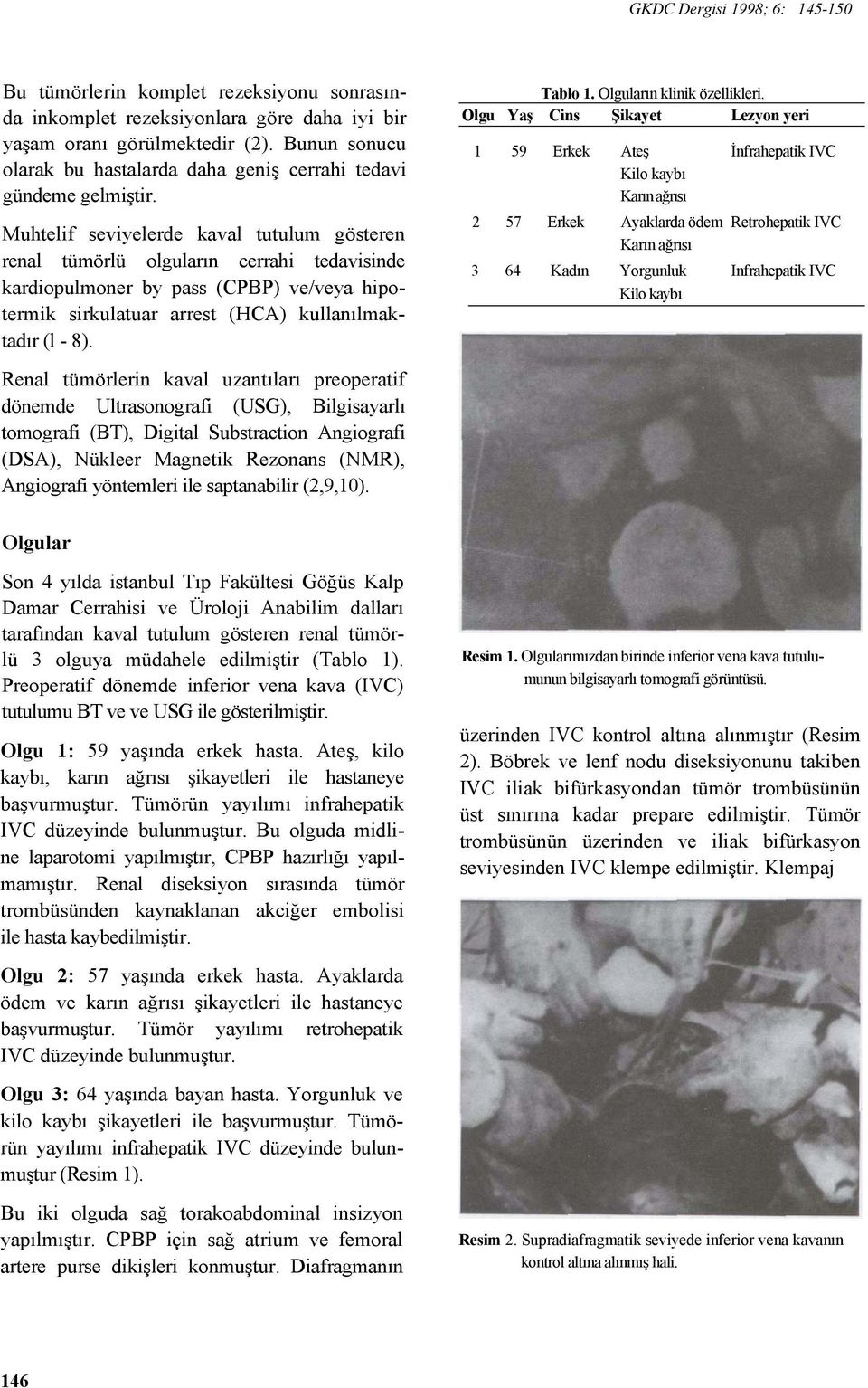 Muhtelif seviyelerde kaval tutulum gösteren renal tümörlü olguların cerrahi tedavisinde kardiopulmoner by pass (CPBP) ve/veya hipotermik sirkulatuar arrest (HCA) kullanılmaktadır (l - 8). Tablo 1.