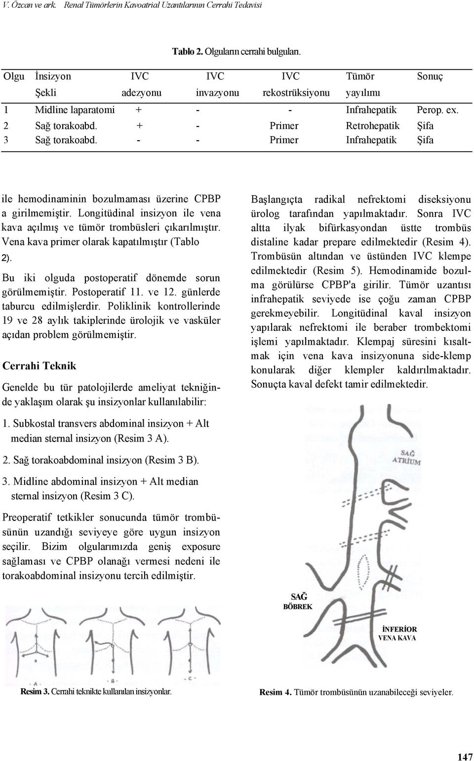 + - Primer Retrohepatik Şifa 3 Sağ torakoabd. - - Primer Infrahepatik Şifa ile hemodinaminin bozulmaması üzerine CPBP a girilmemiştir.