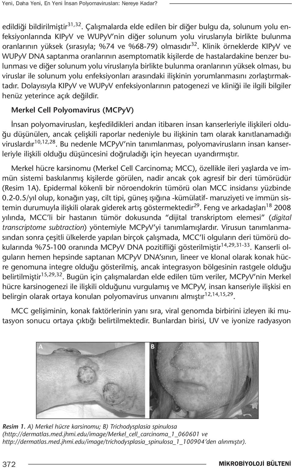 32. Klinik örneklerde KIPyV ve WUPyV DNA saptanma oranlarının asemptomatik kişilerde de hastalardakine benzer bulunması ve diğer solunum yolu viruslarıyla birlikte bulunma oranlarının yüksek olması,