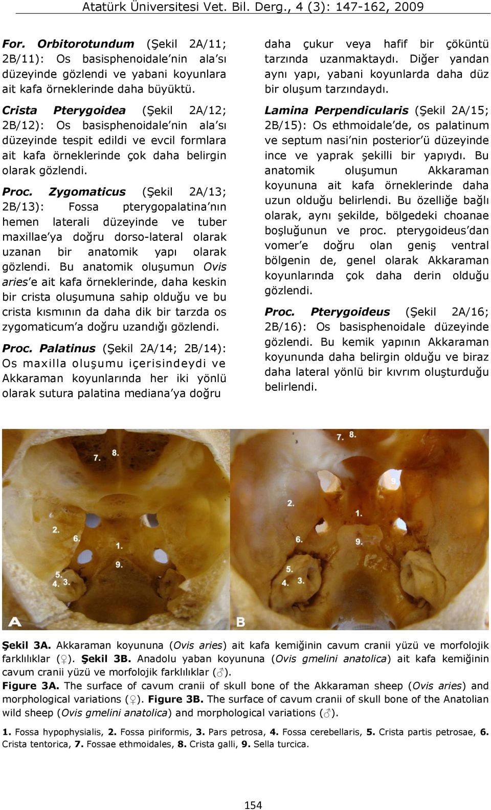 Zygomaticus (Şekil 2A/13; 2B/13): Fossa pterygopalatina nın hemen laterali düzeyinde ve tuber maxillae ya doğru dorso-lateral olarak uzanan bir anatomik yapı olarak gözlendi.