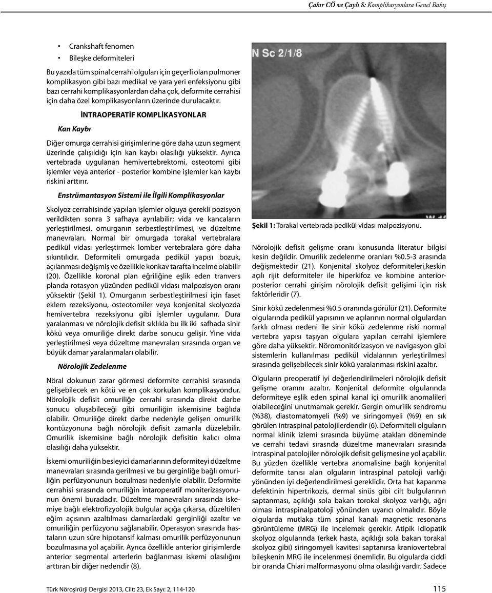 Kan Kaybı İNTRAOPERATİF KOMPLİKASYONLAR Diğer omurga cerrahisi girişimlerine göre daha uzun segment üzerinde çalışıldığı için kan kaybı olasılığı yüksektir.