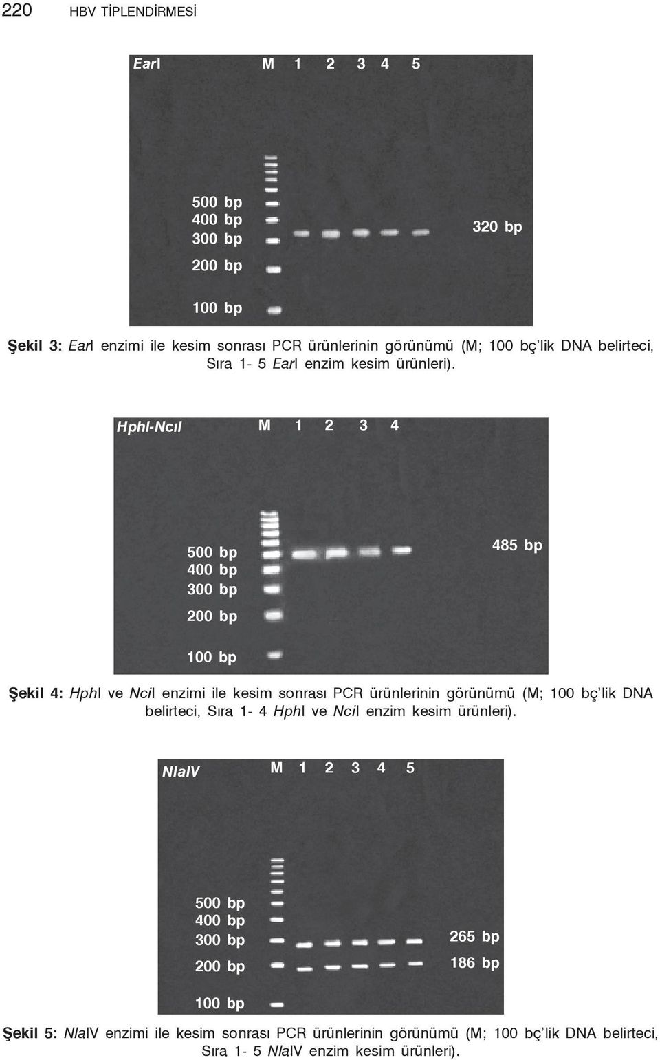 Hphl-Ncıl M 1 2 3 4 500 bp 400 bp 300 bp 200 bp 485 bp 100 bp Şekil 4: HphI ve NciI enzimi ile kesim sonrası PCR ürünlerinin görünümü (M; 100 bç lik DNA