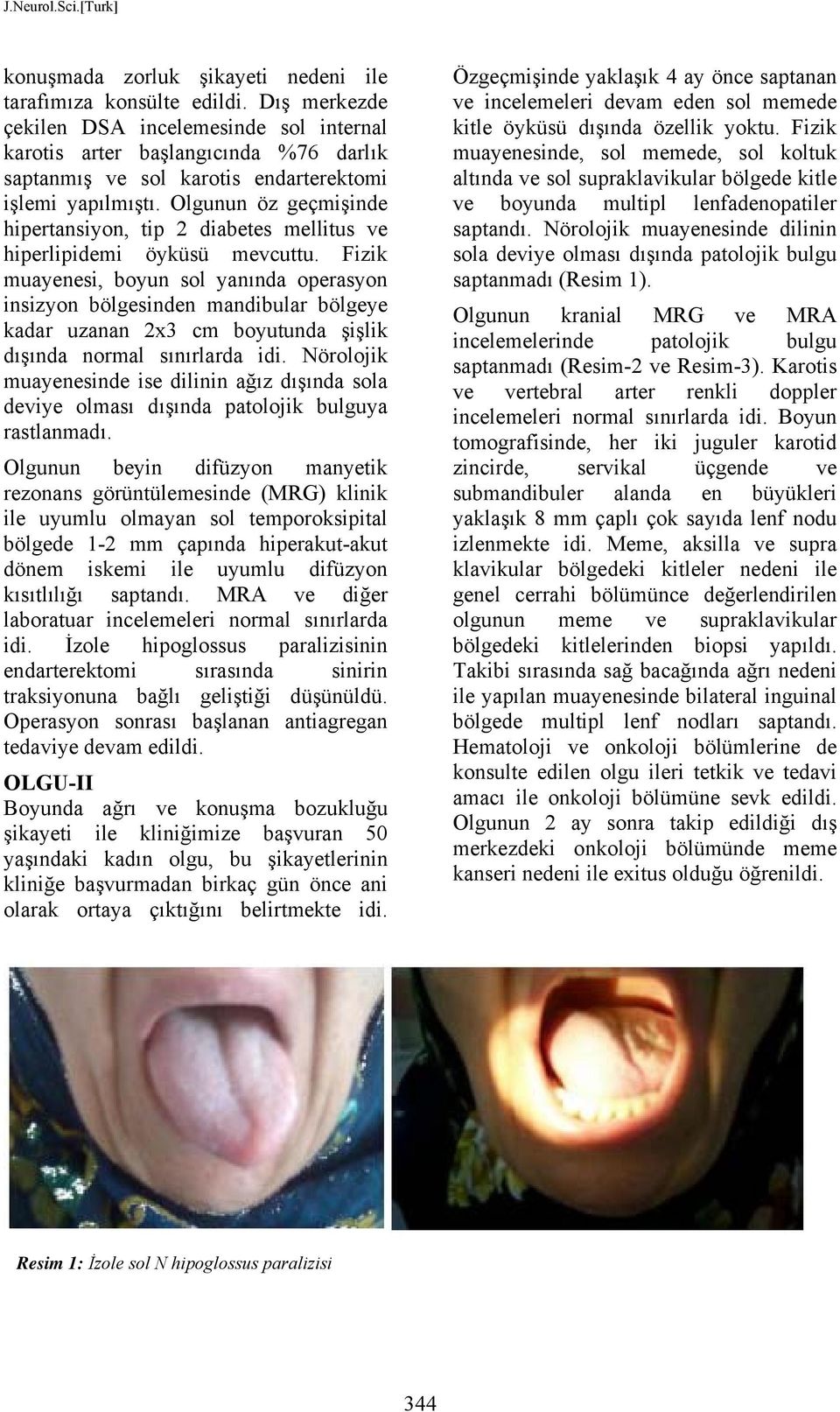 Olgunun öz geçmişinde hipertansiyon, tip 2 diabetes mellitus ve hiperlipidemi öyküsü mevcuttu.