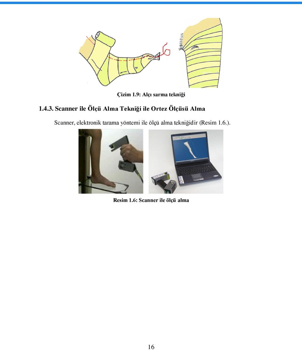 Alma Scanner, elektronik tarama yöntemi ile ölçü