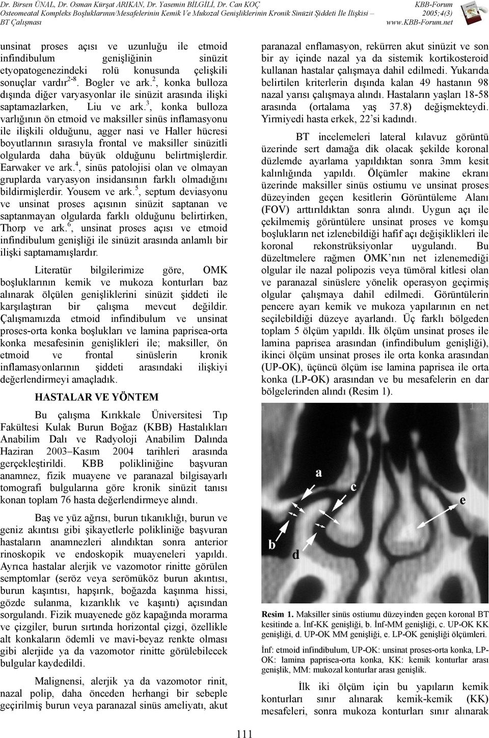 3, konka bulloza varlığının ön etmoid ve maksiller sinüs inflamasyonu ile ilişkili olduğunu, agger nasi ve Haller hücresi boyutlarının sırasıyla frontal ve maksiller sinüzitli olgularda daha büyük