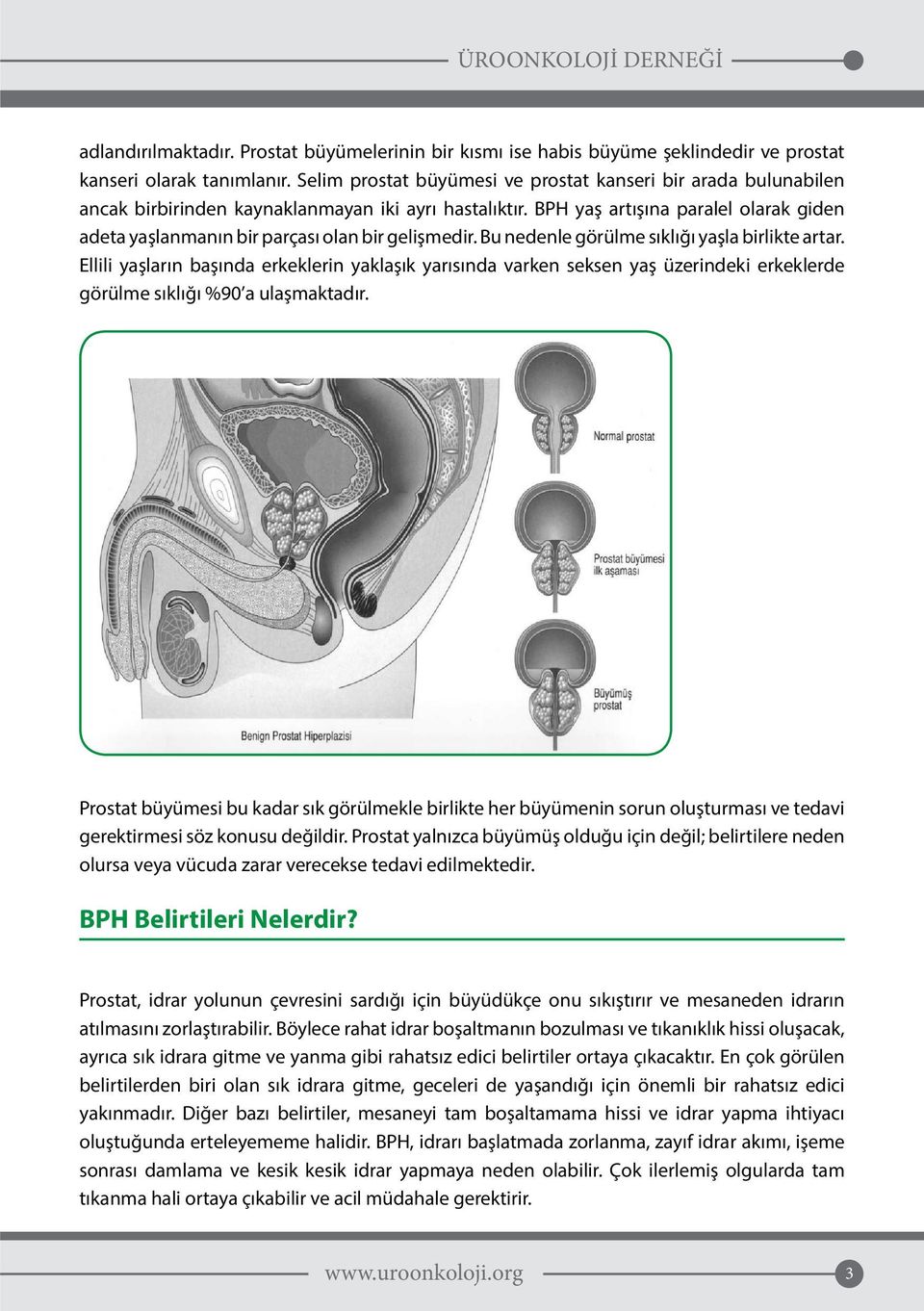 BPH yaş artışına paralel olarak giden adeta yaşlanmanın bir parçası olan bir gelişmedir. Bu nedenle görülme sıklığı yaşla birlikte artar.