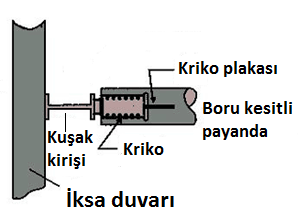 Destek direkleri (payandalar kendi yükleri altında düşmelerine engel olur, payandalara düşey yönde destek olur).