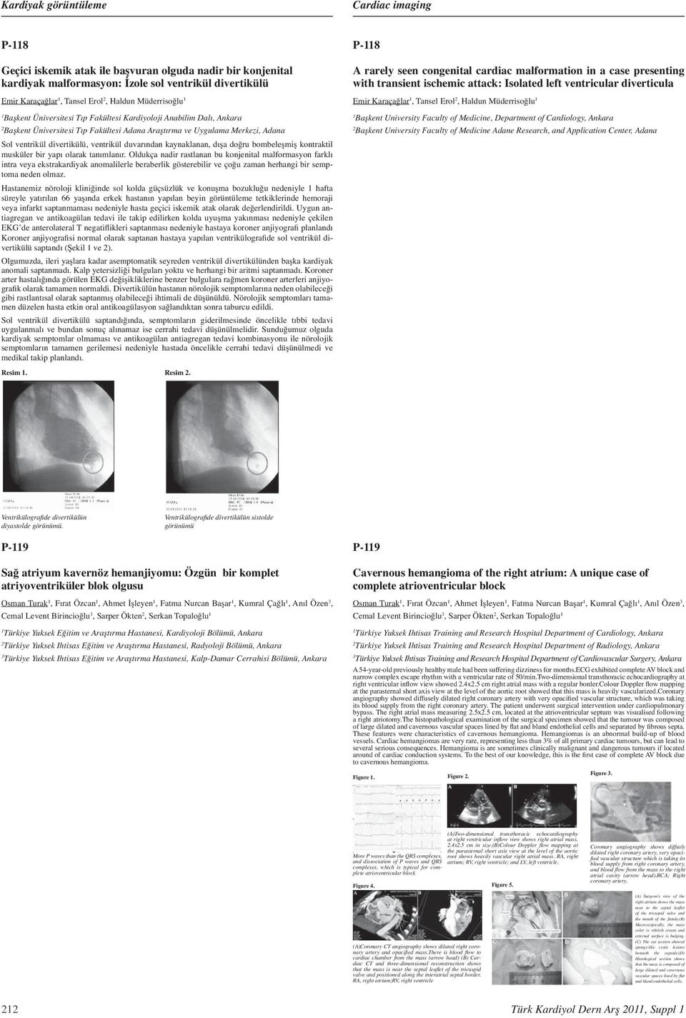 malformation in a case presenting with transient ischemic attack: Isolated left ventricular diverticula Emir Karaçağlar, Tansel Erol, Haldun Müderrisoğlu Başkent University Faculty of Medicine,