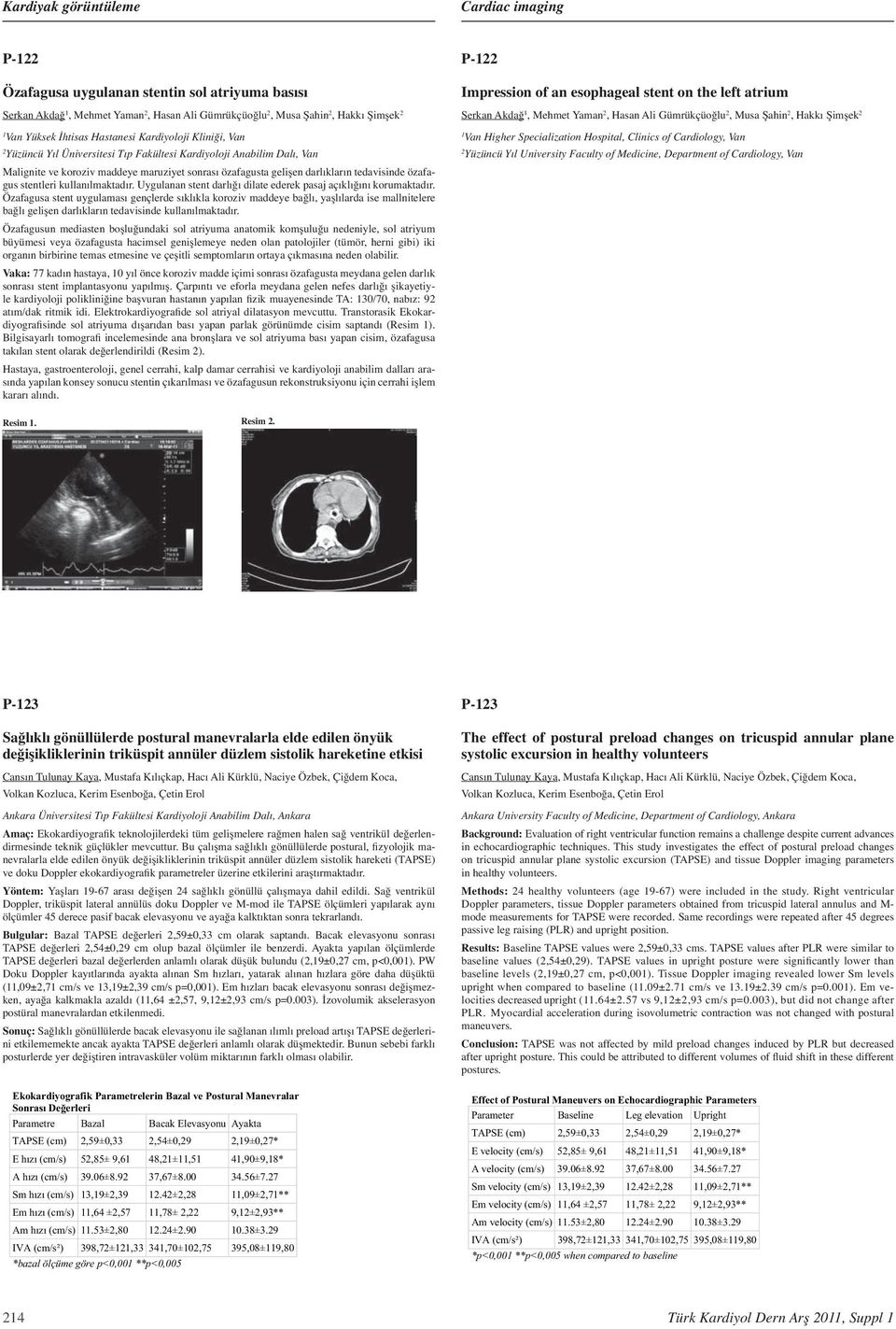 Gümrükçüoğlu, Musa Şahin, Hakkı Şimşek Van Higher Specialization Hospital, Clinics of Cardiology, Van Yüzüncü Yıl University Faculty of Medicine, Department of Cardiology, Van Malignite ve koroziv