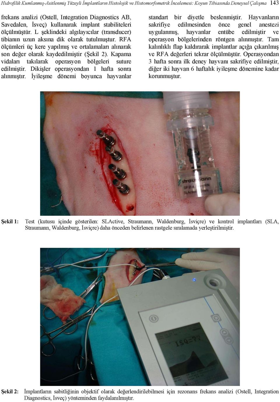 RFA ölçümleri üç kere yapılmış ve ortalamaları alınarak son değer olarak kaydedilmiştir (Şekil 2). Kapama vidaları takılarak operasyon bölgeleri suture edilmiştir.