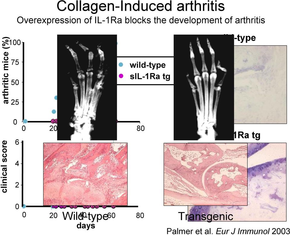 sil-1ra tg wild-type clinical score 0 6 4 2 0 20 40 60 80 sil-1ra tg