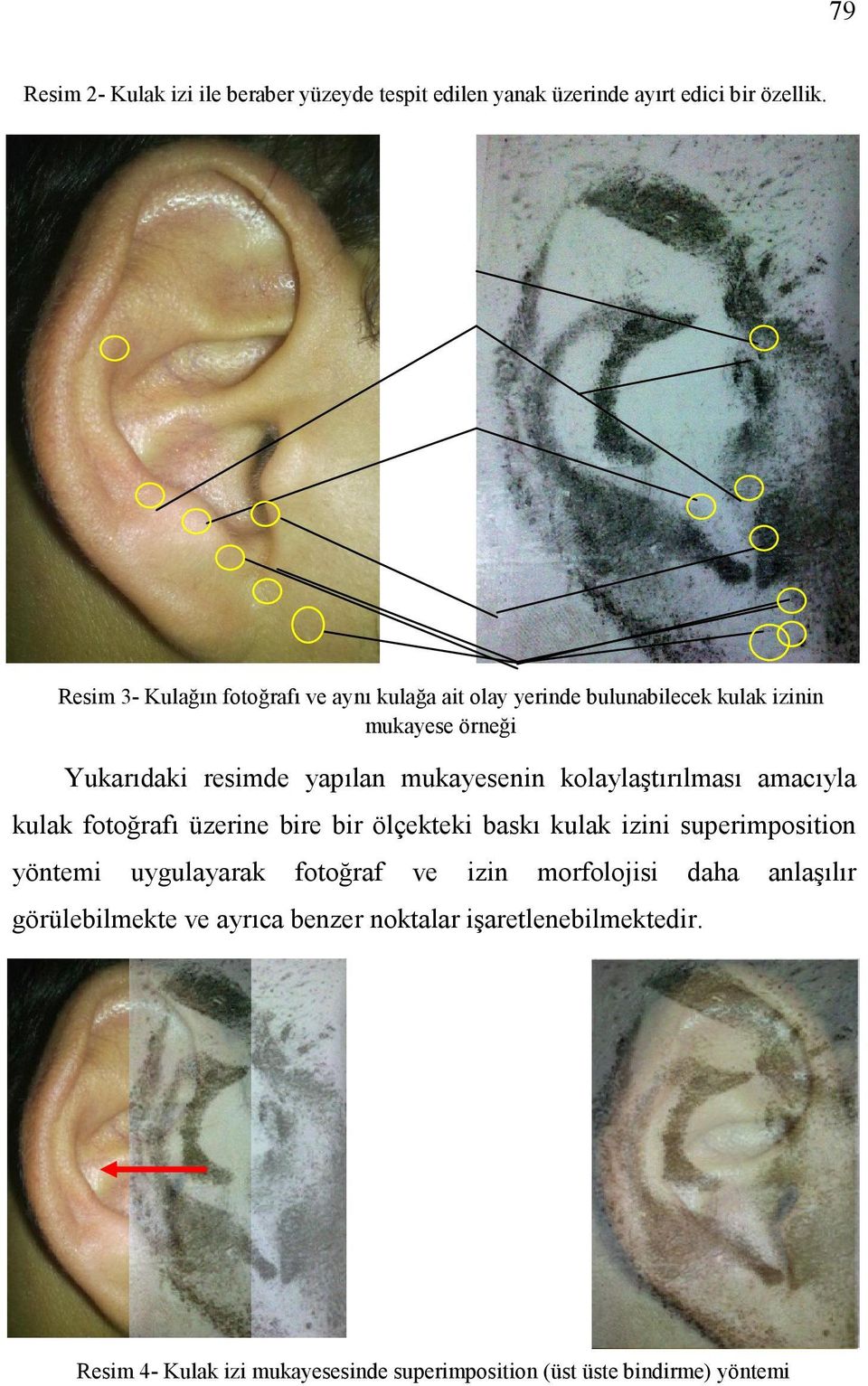 mukayesenin kolaylaştırılması amacıyla kulak fotoğrafı üzerine bire bir ölçekteki baskı kulak izini superimposition yöntemi uygulayarak