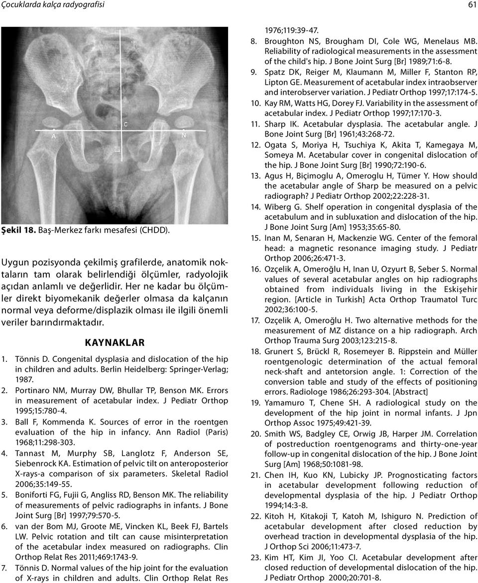 Her ne kadar bu ölçümler direkt biyomekanik değerler olmasa da kalçanın normal veya deforme/displazik olması ile ilgili önemli veriler barındırmaktadır. KAYNAKLAR 1. Tönnis D.