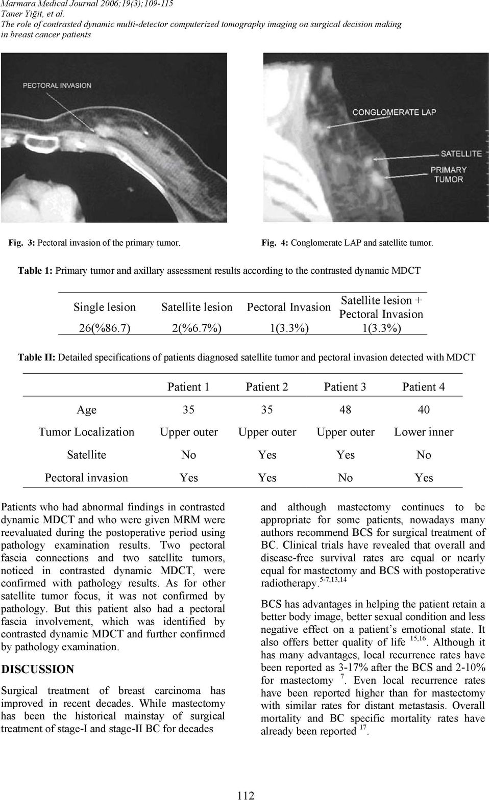 Table 1: Primary tumor and axillary assessment results according to the contrasted dynamic MDCT Single lesion Satellite lesion Pectoral Invasion Satellite lesion + Pectoral Invasion 26(%86.7) 2(%6.