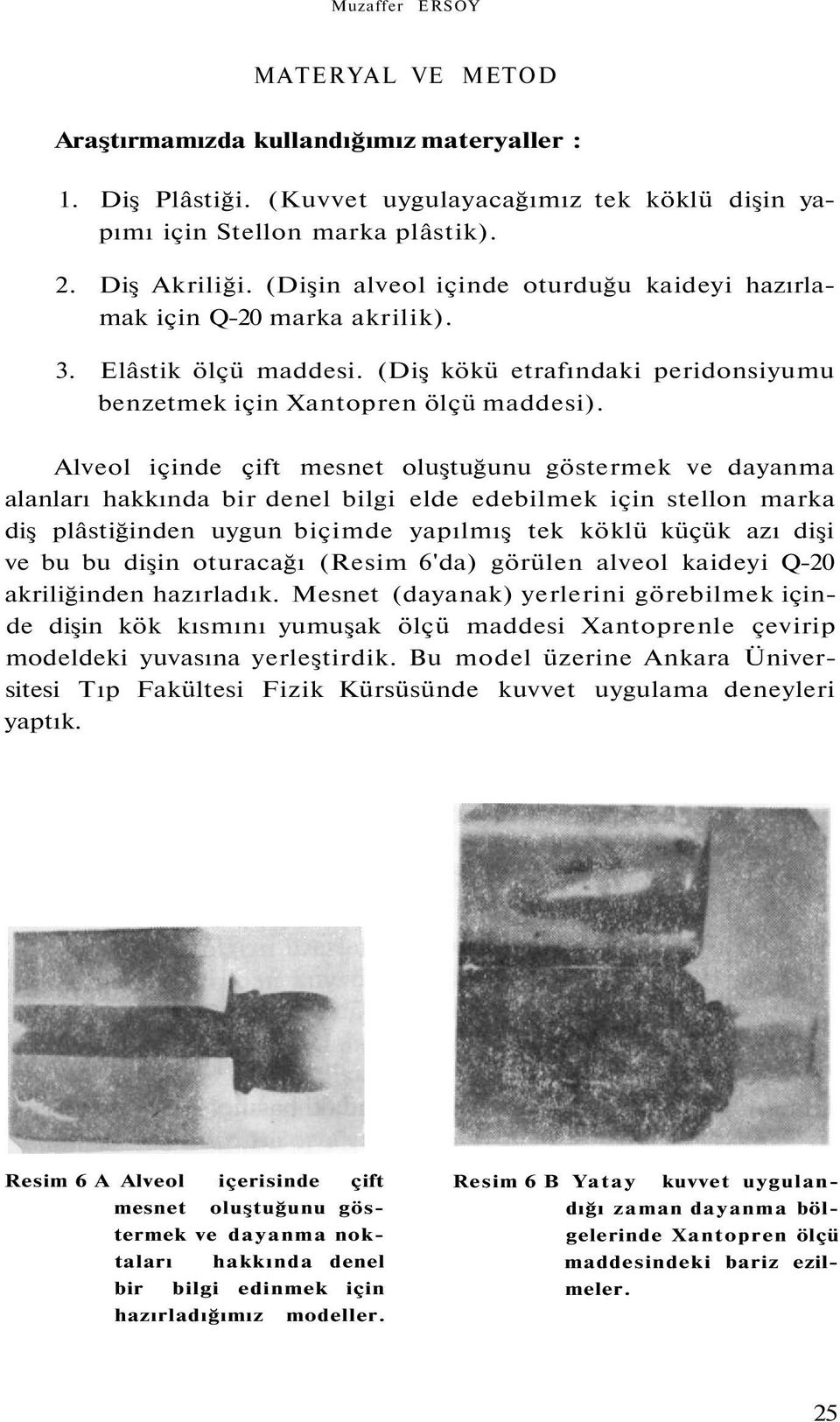 Alveol içinde çift mesnet oluştuğunu göstermek ve dayanma alanları hakkında bir denel bilgi elde edebilmek için stellon marka diş plâstiğinden uygun biçimde yapılmış tek köklü küçük azı dişi ve bu bu