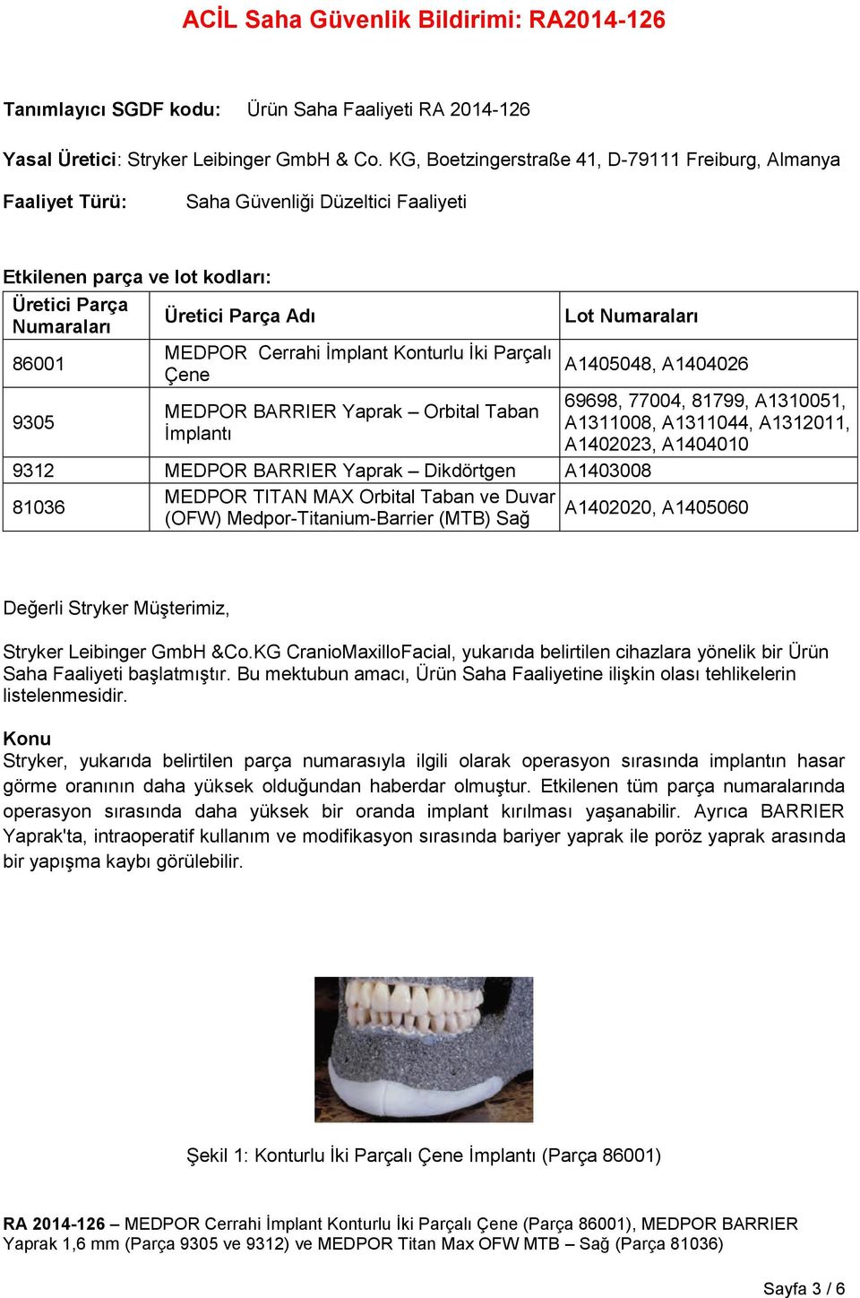 Cerrahi İmplant Konturlu İki Parçalı Çene MEDPOR BARRIER Yaprak Orbital Taban İmplantı Lot Numaraları A1405048, A1404026 69698, 77004, 81799, A1310051, A1311008, A1311044, A1312011, A1402023,