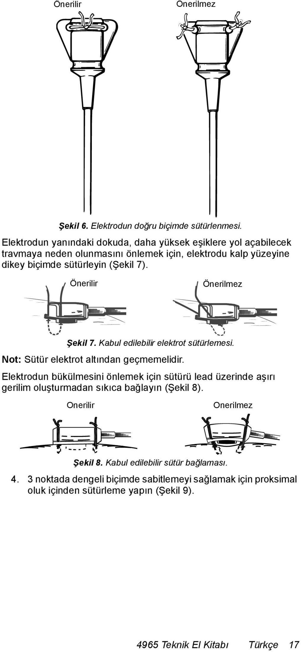 7). Önerilir Önerilmez Şekil 7. Kabul edilebilir elektrot sütürlemesi. Not: Sütür elektrot altından geçmemelidir.