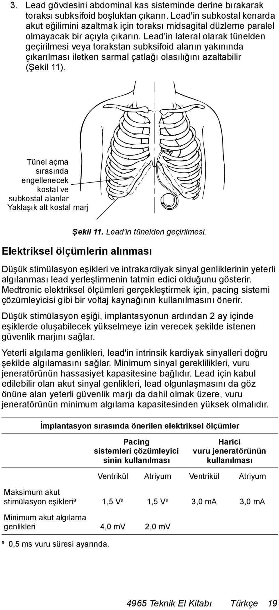 Lead'in lateral olarak tünelden geçirilmesi veya torakstan subksifoid alanın yakınında çıkarılması iletken sarmal çatlağı olasılığını azaltabilir (Şekil 11).