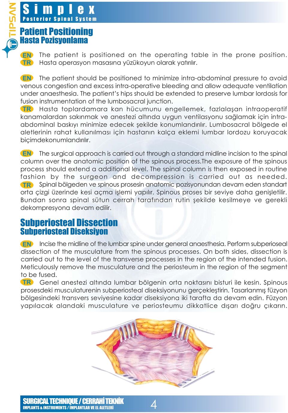 The patient s hips should be extended to preserve lumbar lordosis for fusion instrumentation of the lumbosacral junction.