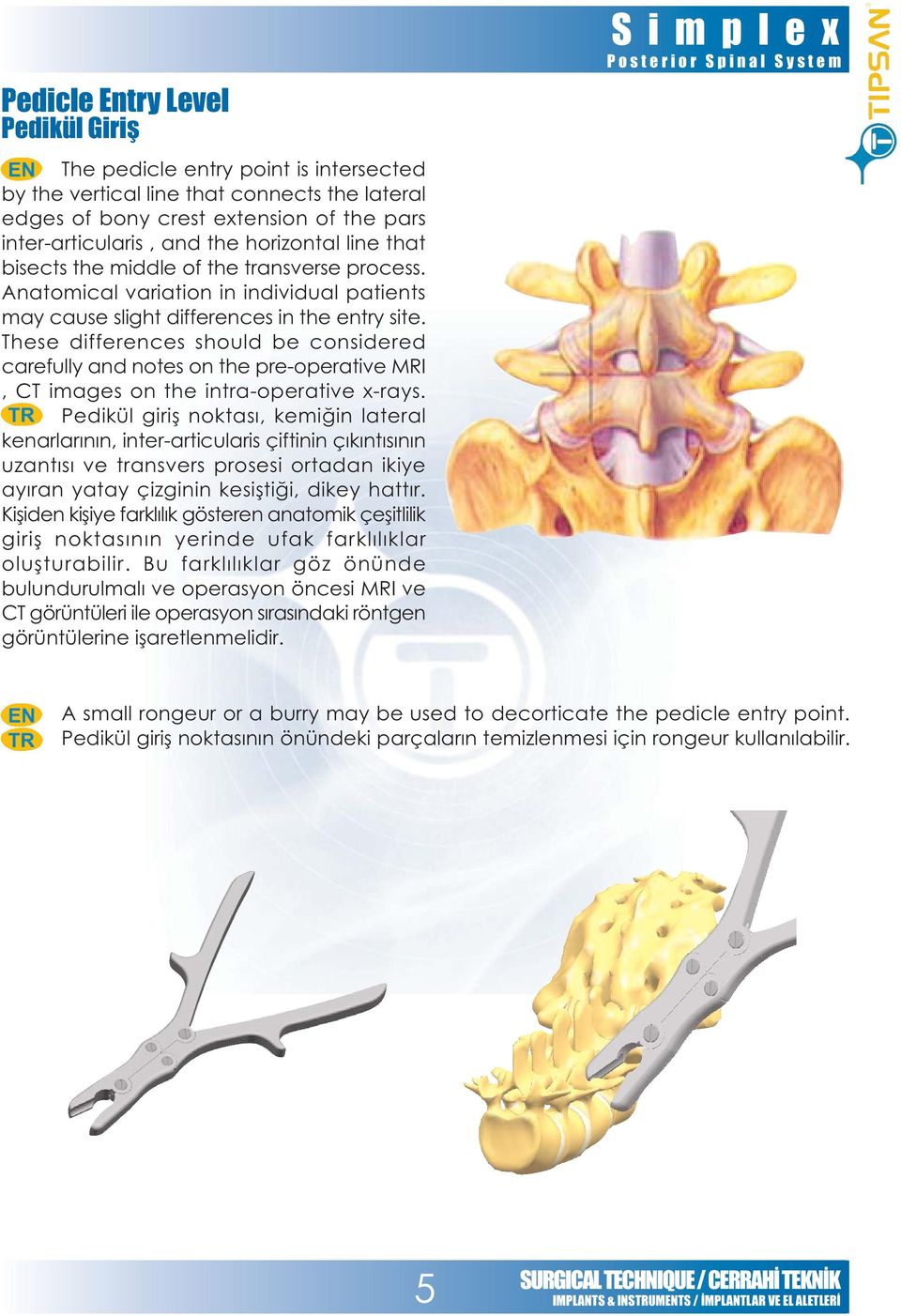 These differences should be considered carefully and notes on the pre-operative MRI, CT images on the intra-operative x-rays.