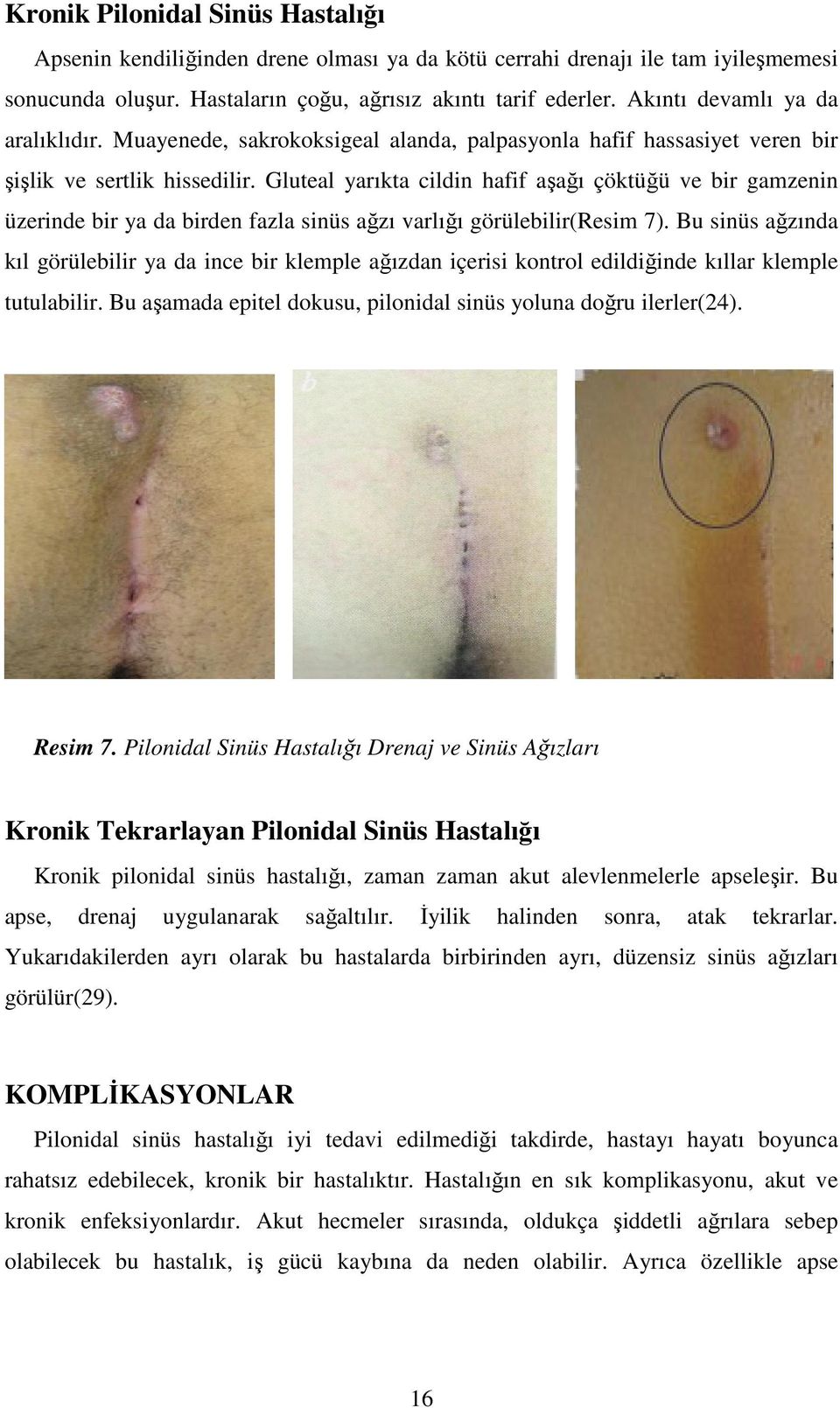 Gluteal yarıkta cildin hafif aşağı çöktüğü ve bir gamzenin üzerinde bir ya da birden fazla sinüs ağzı varlığı görülebilir(resim 7).