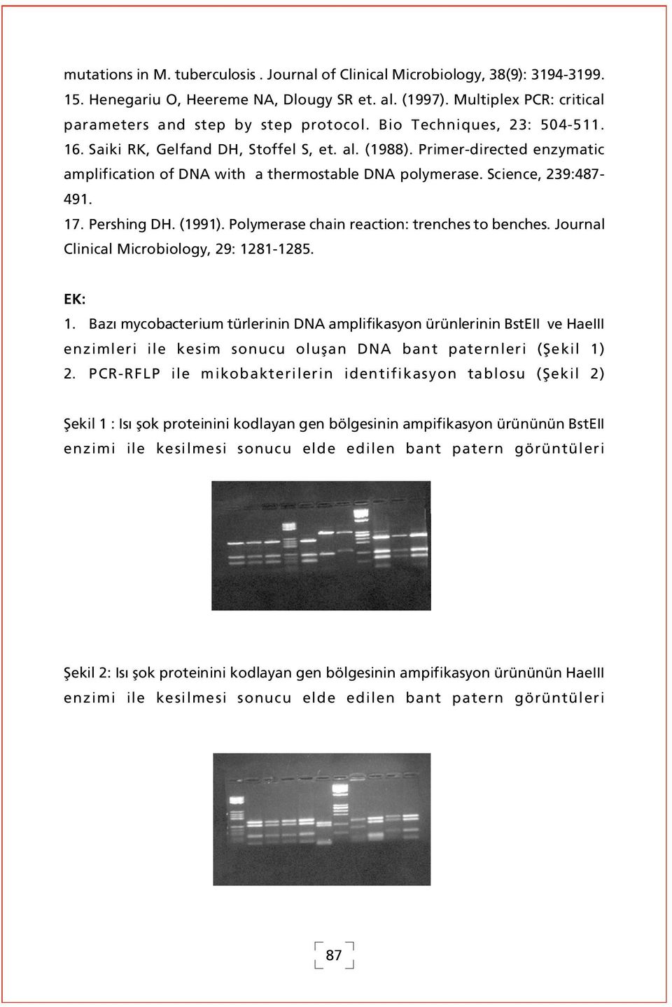 Pershing DH. (1991). Polymerase chain reaction: trenches to benches. Journal Clinical Microbiology, 29: 1281-1285. EK: 1.