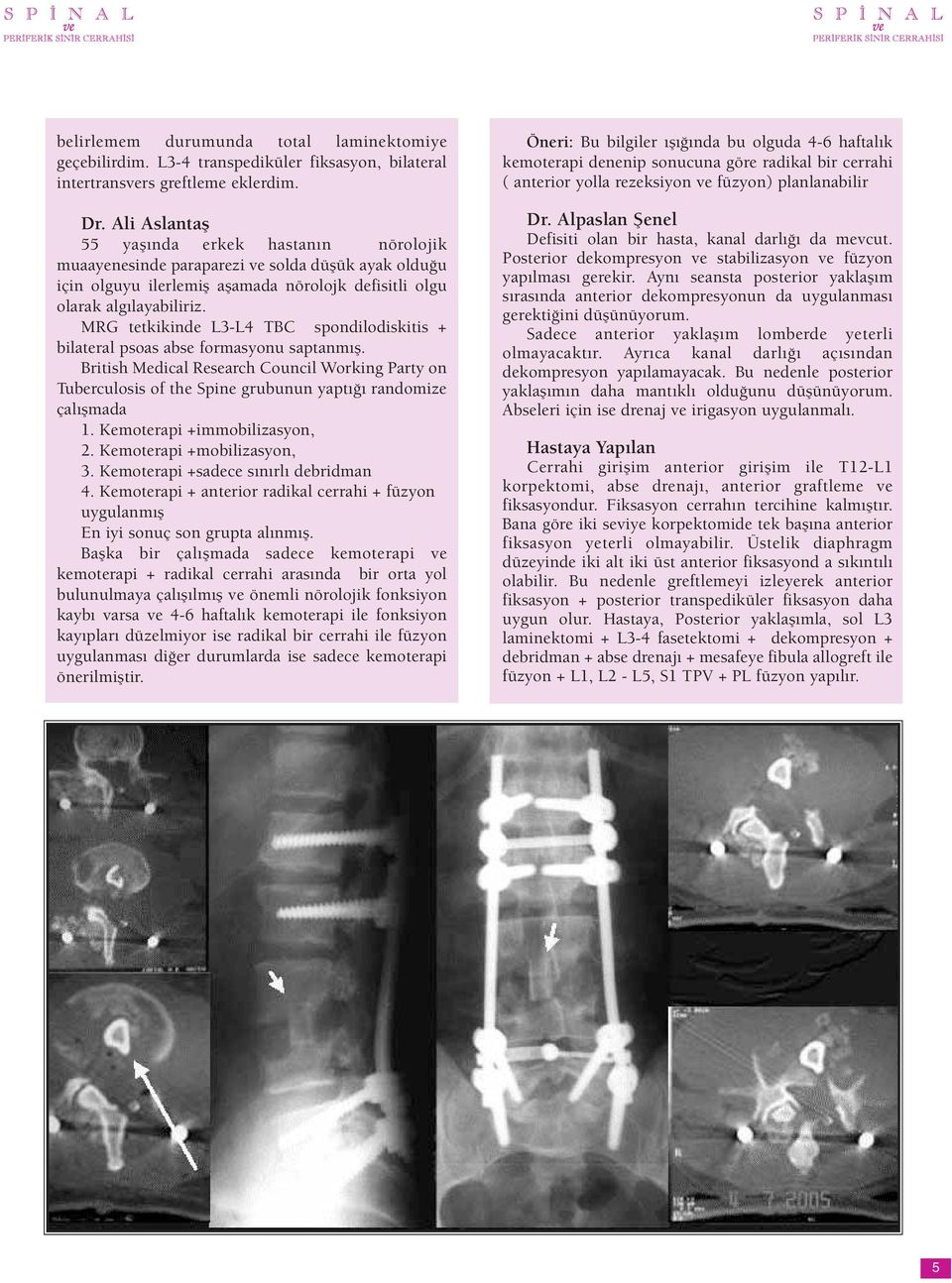 MRG tetkikinde L3-L4 TBC spondilodiskitis + bilateral psoas abse formasyonu saptanmış.