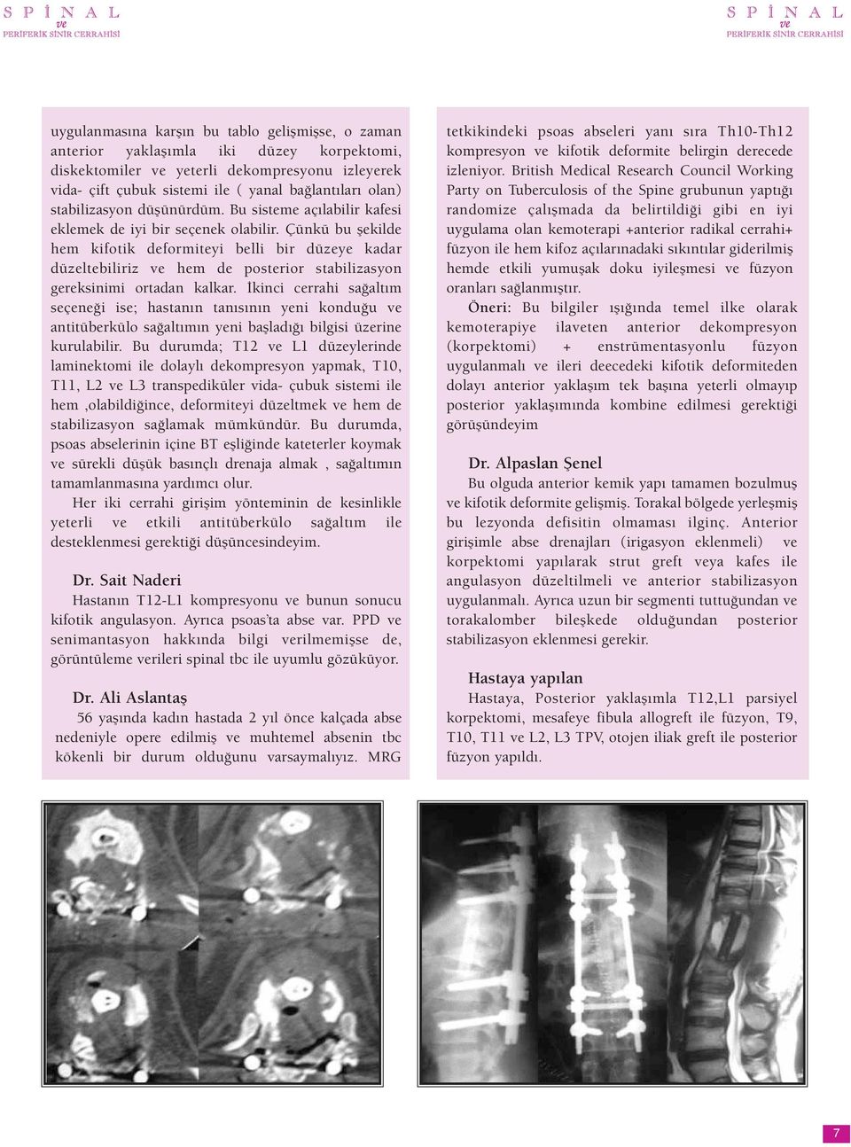 Çünkü bu şekilde hem kifotik deformiteyi belli bir düzeye kadar düzeltebiliriz ve hem de posterior stabilizasyon gereksinimi ortadan kalkar.