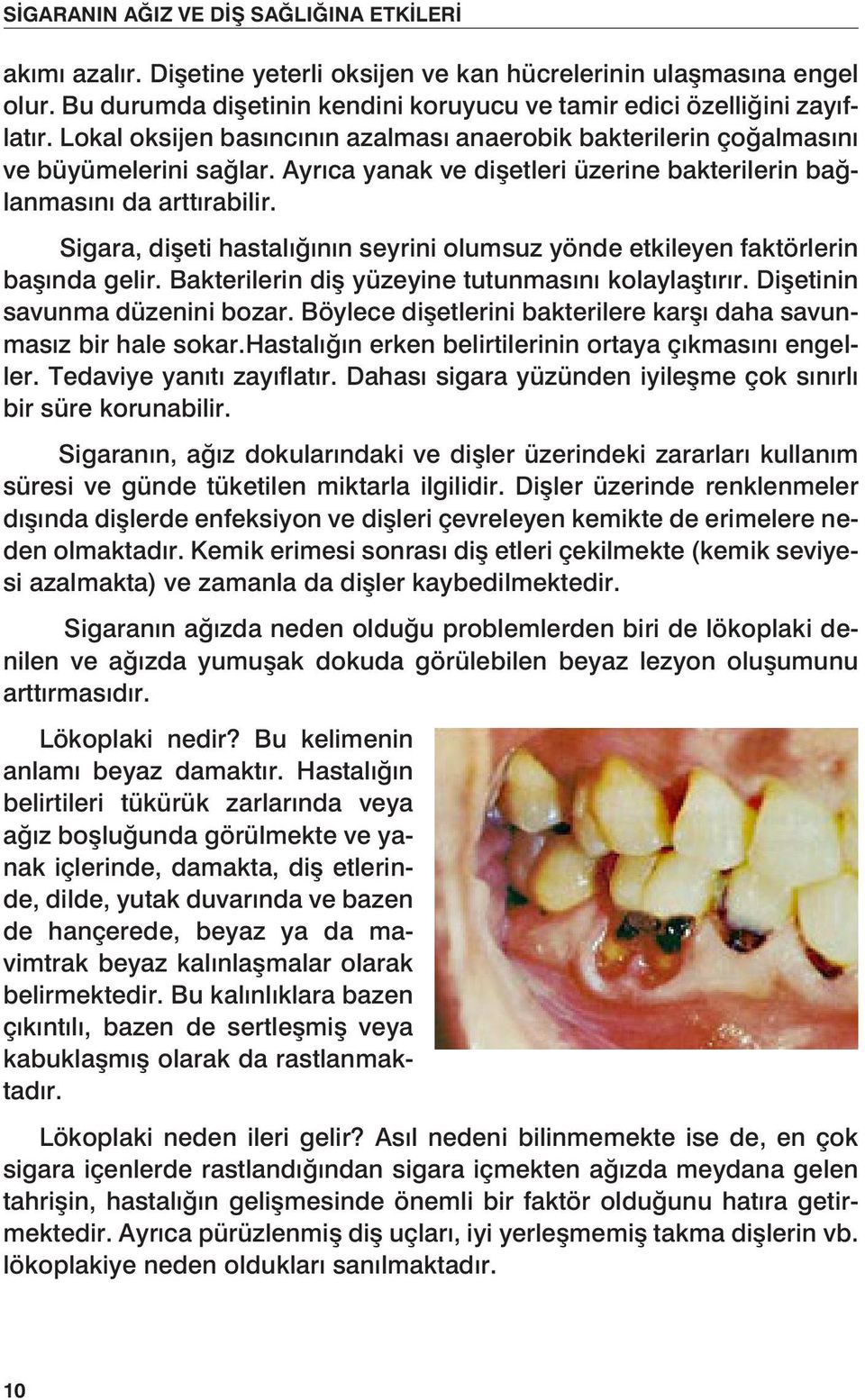 Sigara, dişeti hastalığının seyrini olumsuz yönde etkileyen faktörlerin başında gelir. Bakterilerin diş yüzeyine tutunmasını kolaylaştırır. Dişetinin savunma düzenini bozar.