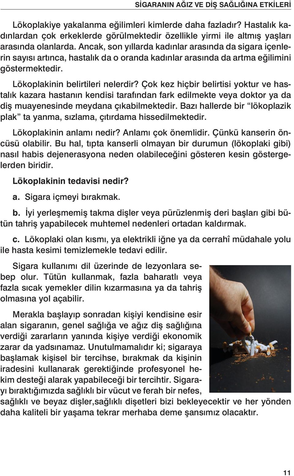 Ancak, son yıllarda kadınlar arasında da sigara içenlerin sayısı artınca, hastalık da o oranda kadınlar arasında da artma eğilimini göstermektedir. Lökoplakinin belirtileri nelerdir?