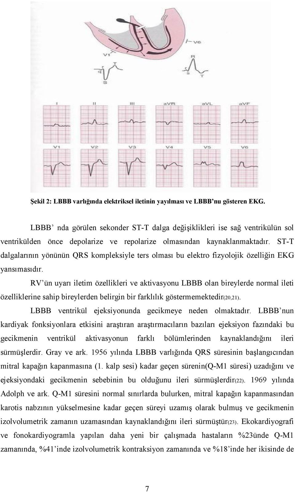 ST-T dalgalarının yönünün QRS kompleksiyle ters olması bu elektro fizyolojik özelliğin EKG yansımasıdır.