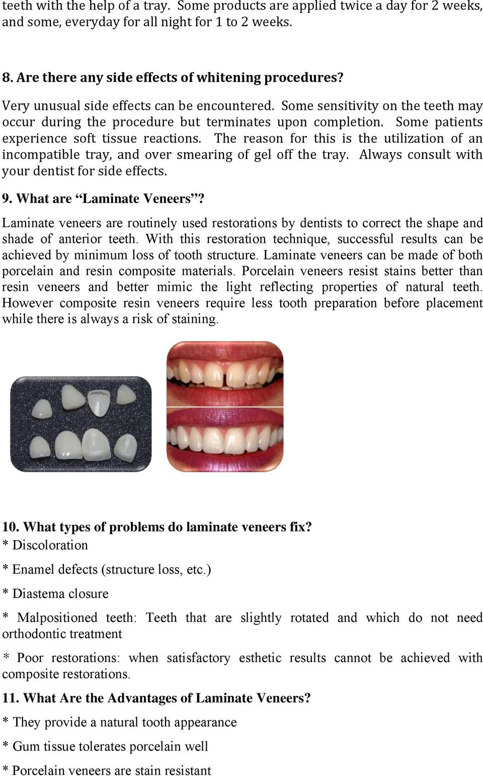 The reason for this is the utilization of an incompatible tray, and over smearing of gel off the tray. Always consult with your dentist for side effects. 9. What are Laminate Veneers?